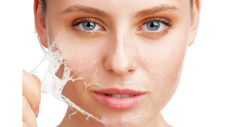 skin during chemical peel treatment