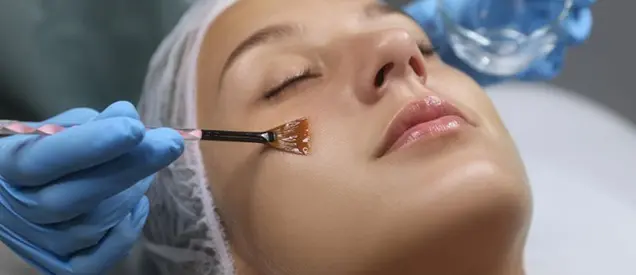 Doctor applying chemical peel solution on patient’s face